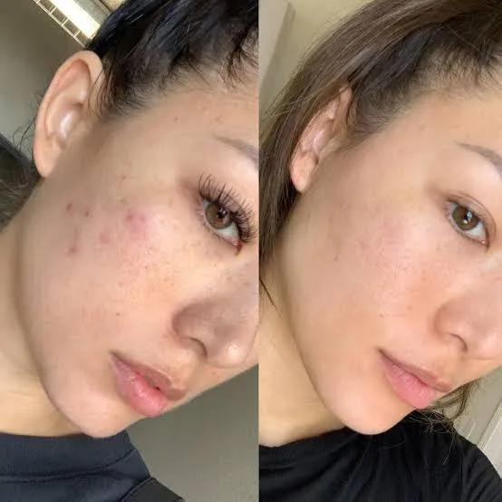 12 Week Detox Skin, Gut & Hormones