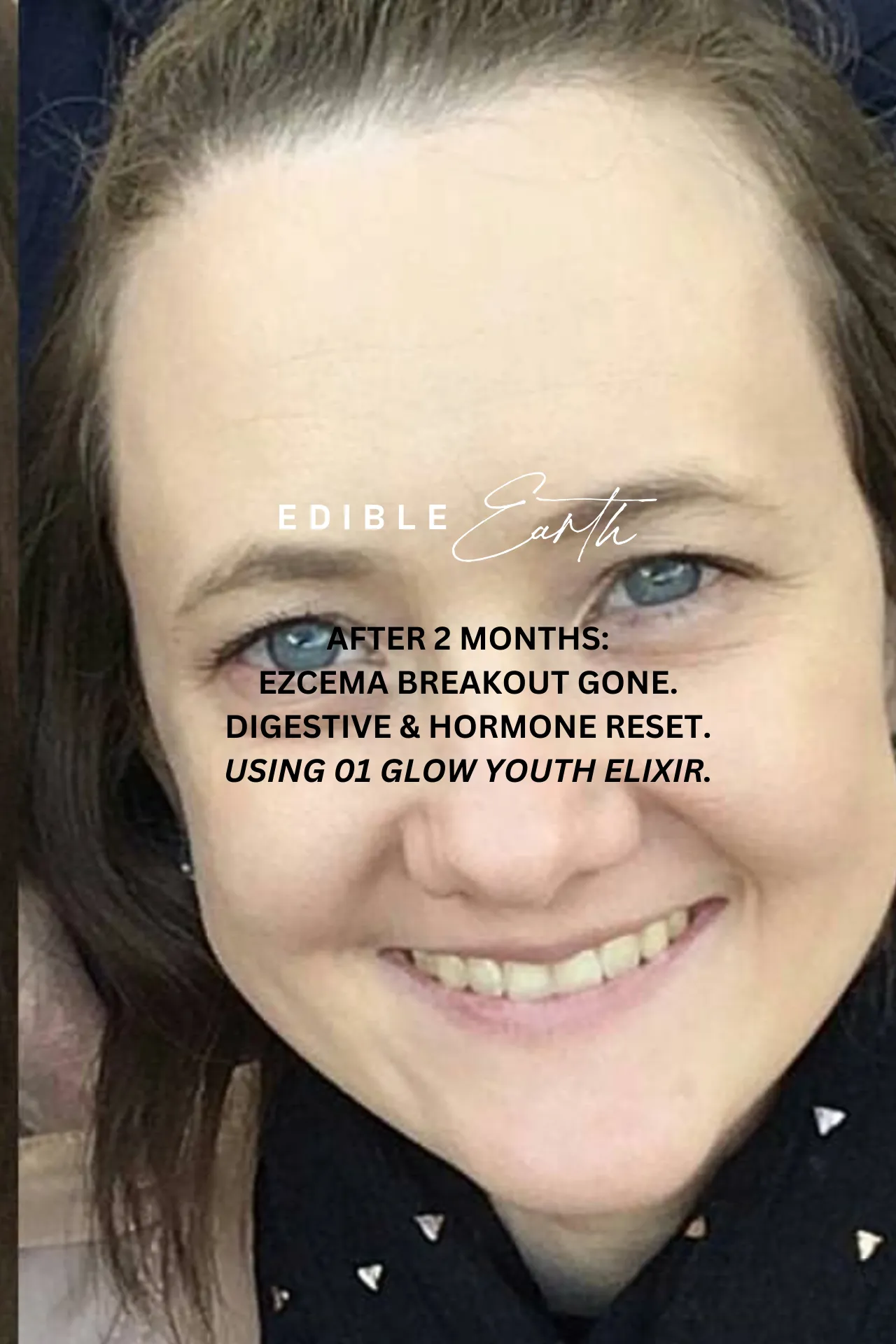 12 Week Detox Skin, Gut & Hormones