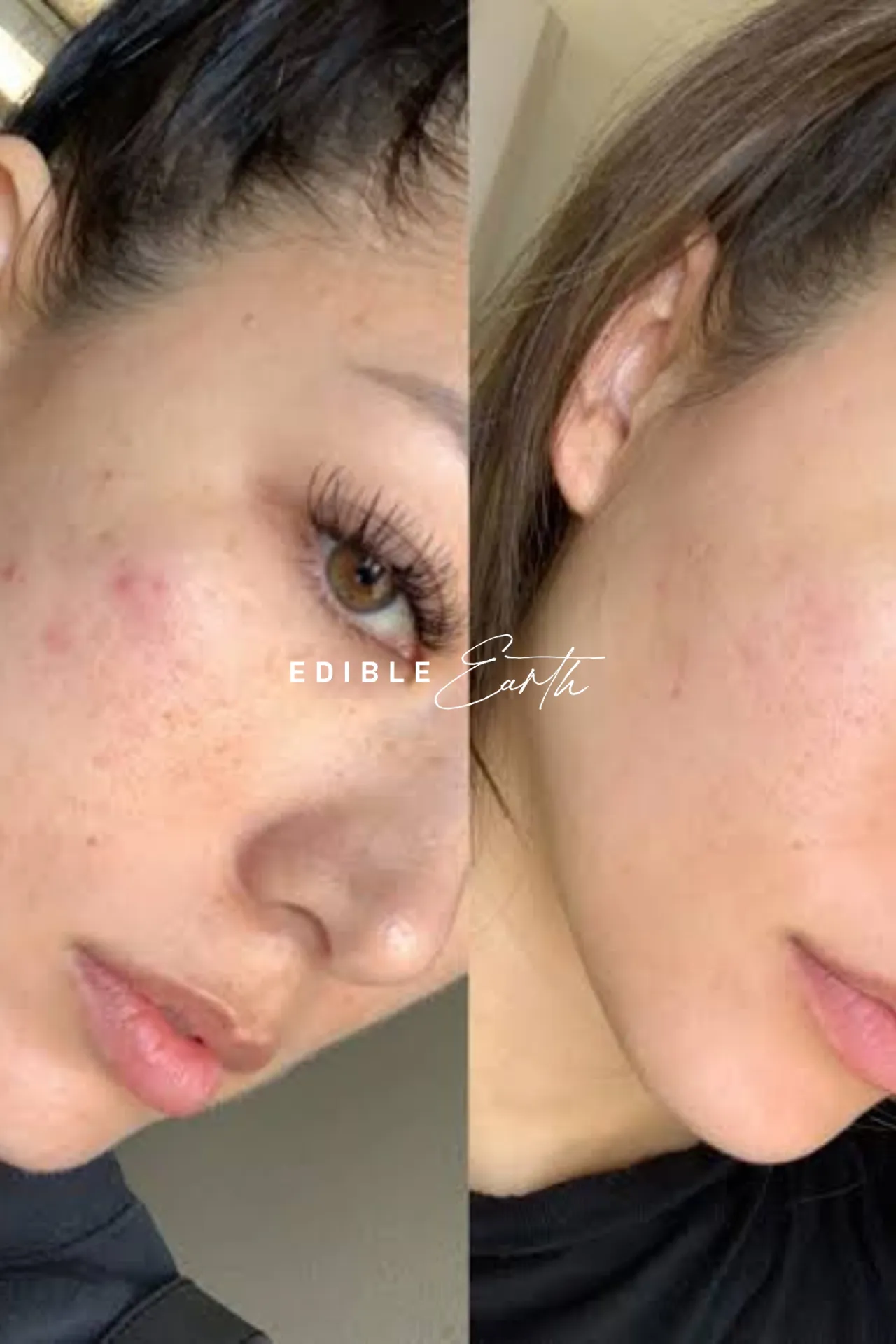 12 Week Detox Skin, Gut & Hormones