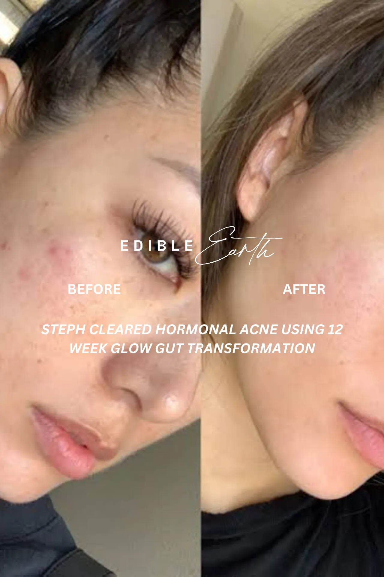 12 Week Detox Skin, Gut & Hormones