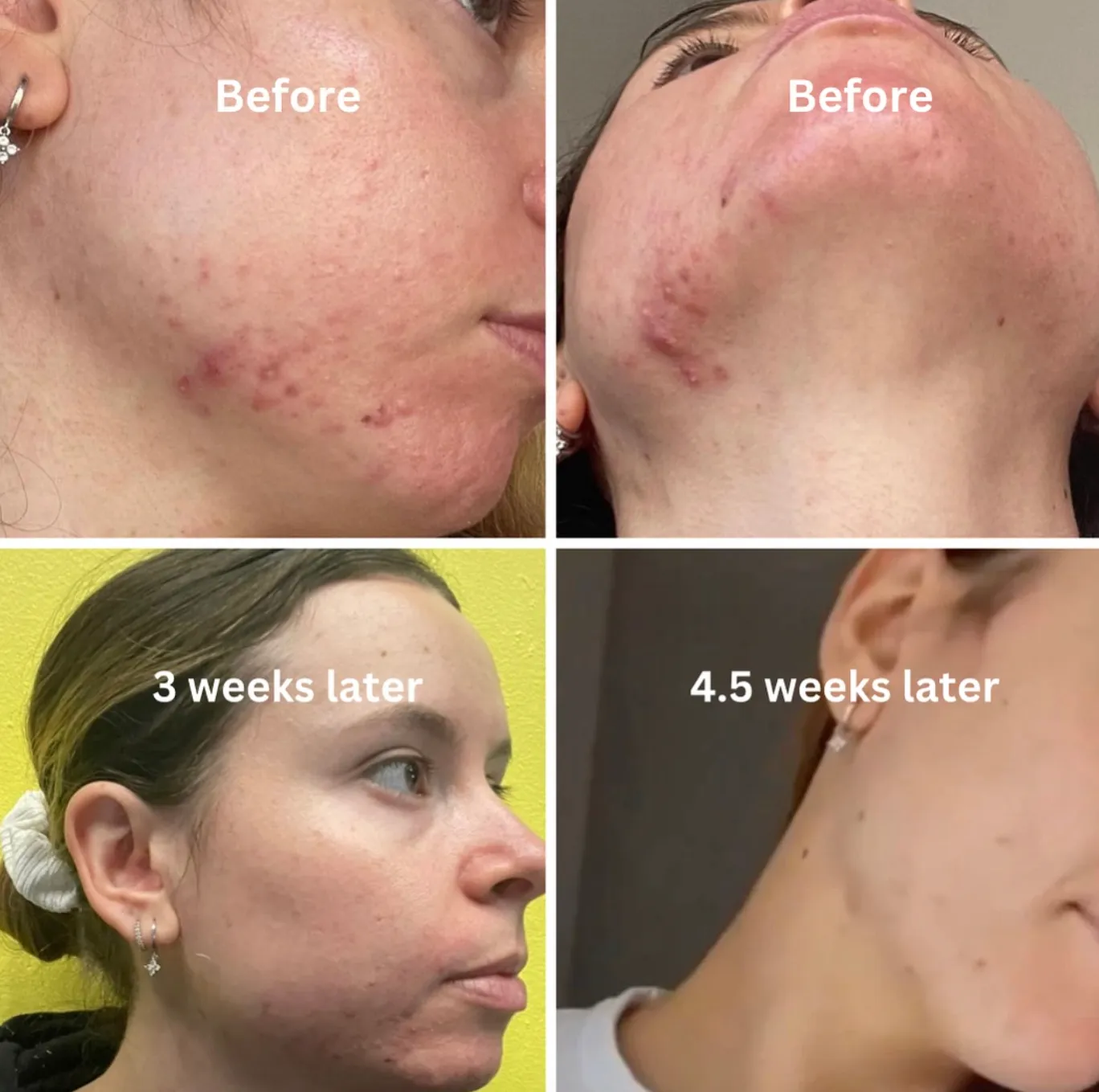 12 Week Detox Skin, Gut & Hormones