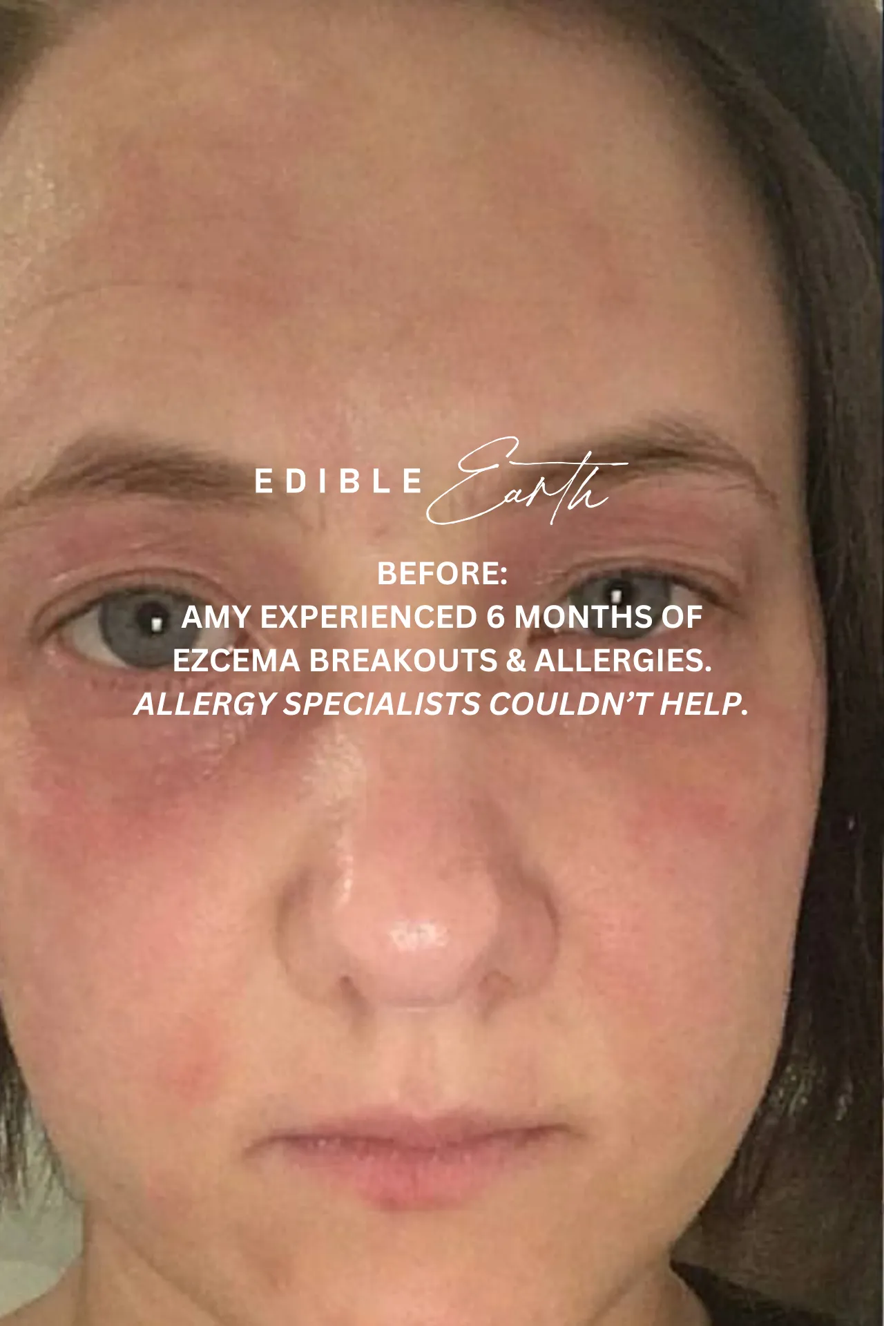 12 Week Detox Skin, Gut & Hormones