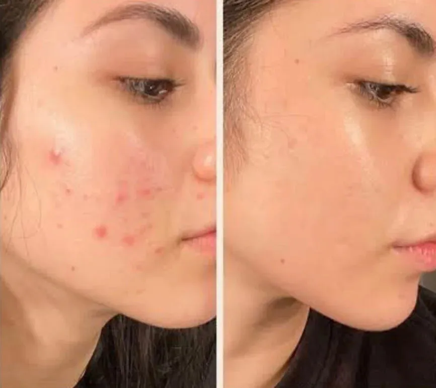 12 Week Detox Skin, Gut & Hormones