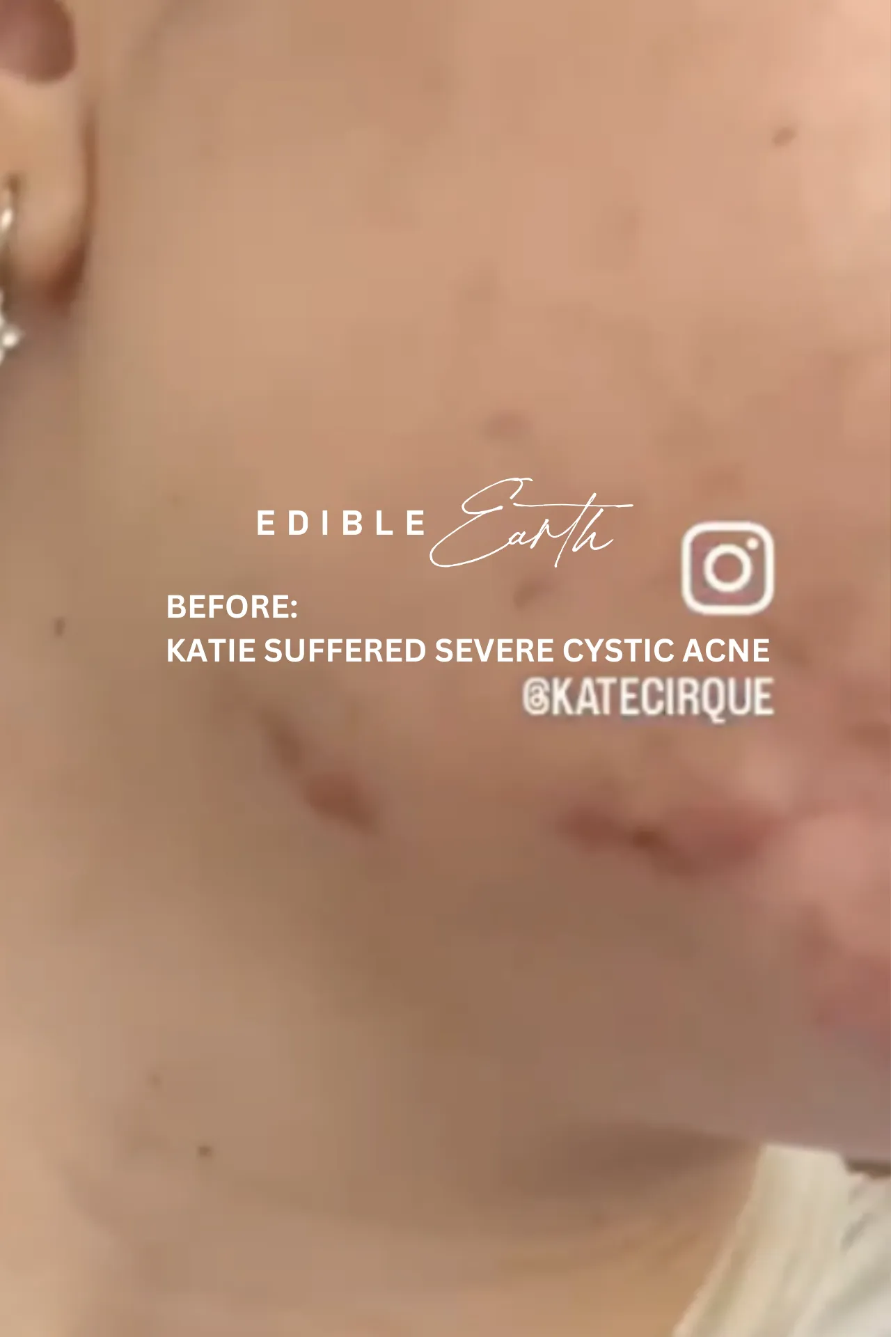 12 Week Detox Skin, Gut & Hormones